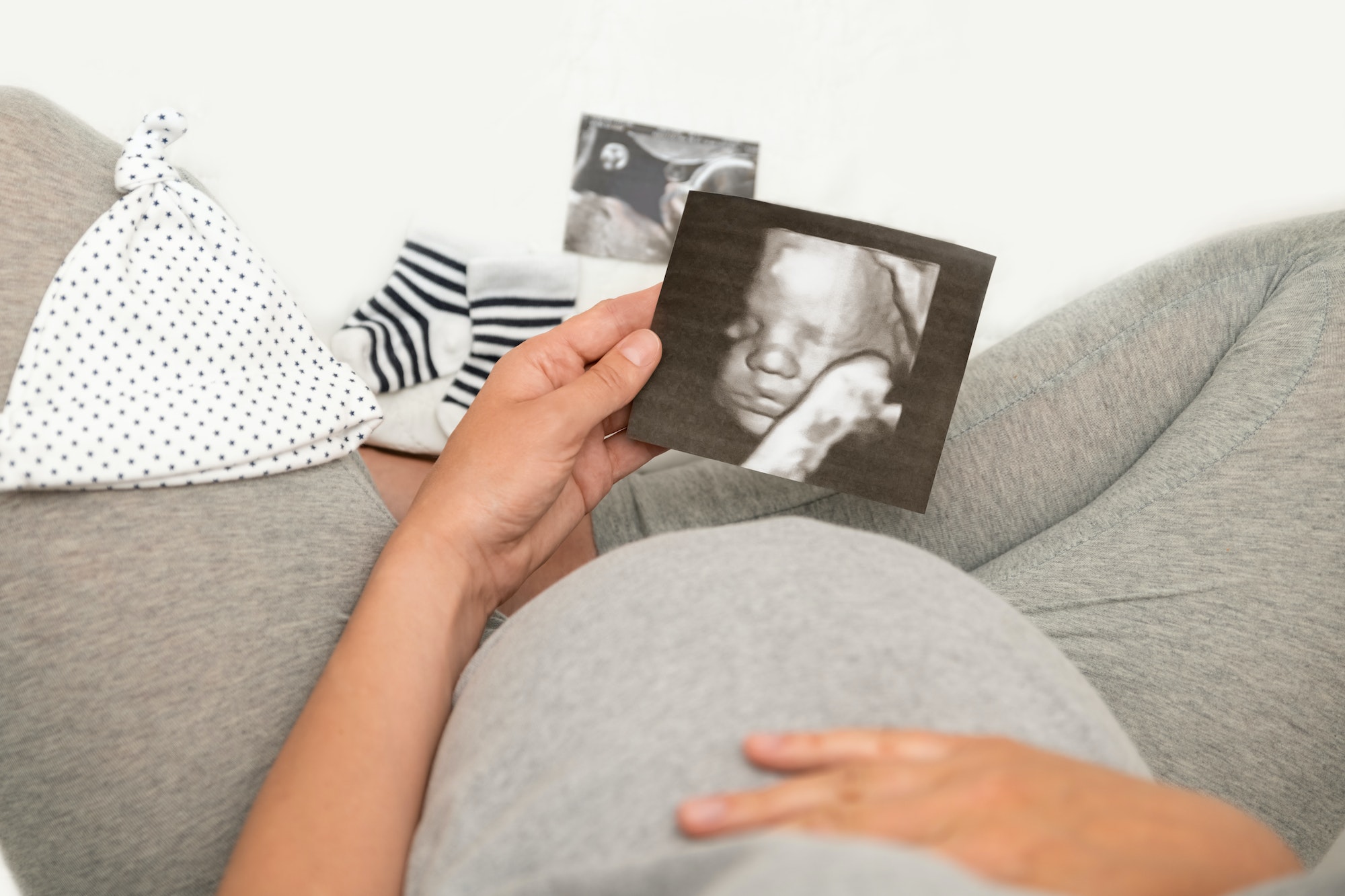 pregnant-woman-holding-4d-ultrasound-image-expectation-of-a-child.jpg